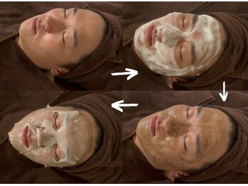 アイル(iru)/ハーブピーリングの流れ