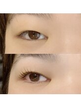 レッドモート(Red moat)/ダブルアイリフト