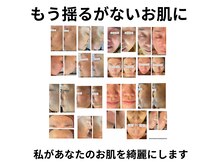 キュアラ(CUARA)