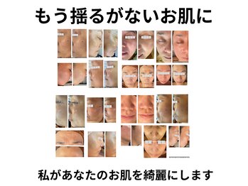 キュアラ(CUARA)