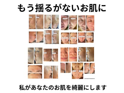 キュアラ(CUARA)の写真