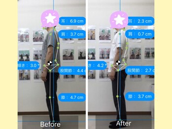 ナオル整体 春日部院(NAORU整体)/肩こりが消え、姿勢が綺麗に