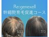 男女対応◎髪のお悩みは幹細胞育毛促進 【re:genexell （リジェネクセル）】