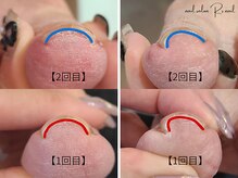 ネイル サロン アールズ ネイル(R's nail)の雰囲気(●1回目2025.8.26●2回目2025.8.30●特殊ジェルで巻き爪ケア)