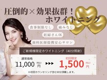 ホワイトニングショップ 山科店