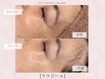 ビベル 八木店(Bebelle)/50代から始める肌育ケア