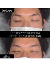 ユー 西船橋店(you)/ビフォーアフター写真