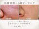 美容鍼灸院ハリエル(HARIel)の写真/毛穴・ニキビ・くすみに◎肌管理ピーリングでつるんと素肌へ