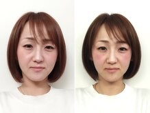 ゆうき式小顔矯正/小顔矯正before＆after