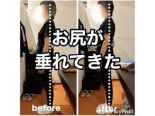 カワル整体 上通り院/【お尻が垂れてきた】