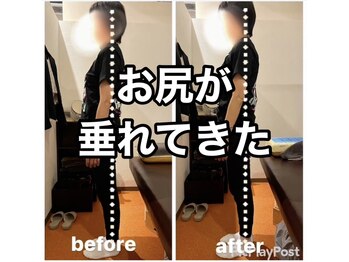 カワル整体 上通り院/【お尻が垂れてきた】