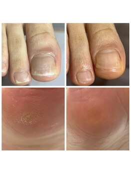 ドクターネイル爪革命 十条店/トータルフットケア