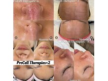 ラストミニットサロン 東京の雰囲気（全米6年連続1位の最新施術プロセルセラピーズで理想のお肌へ）