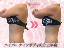 ワイキューマルサン(y903)/ハイパーナイフ上半身