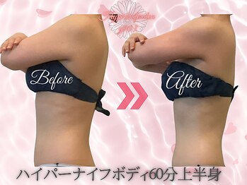 ワイキューマルサン(y903)/ハイパーナイフ上半身