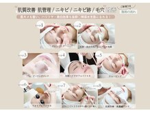 ビズビズ 梅田店(bisebise)/肌質改善ニキビ/跡/毛穴クーポン