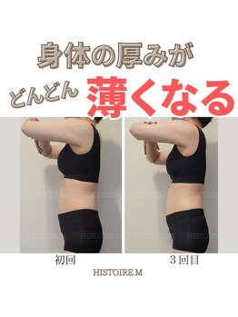 イストアールエム(HISTOIRE.M)/筋膜リリースダイエットコース