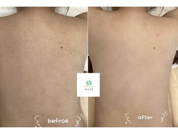 ミューズ 成城(MUSE)/