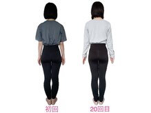 フォーシー(4C)/Before/After