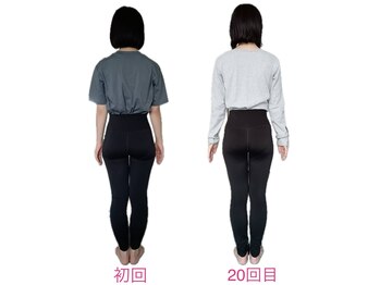 フォーシー(4C)/Before/After