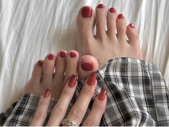 恵比寿ミリ(mm)の写真/【巻き爪矯正ならnailmmで◎】爪のお悩みぜひご相談ください♪丁寧にカウンセリングし、改善します☆