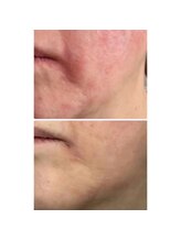 マリエンドリー/肌荒れもお任せ下さい