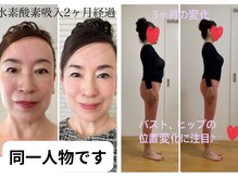 ヨサパーク エミリア(YOSA PARK Emiria)