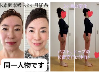 ヨサパーク エミリア(YOSA PARK Emiria)