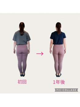 フォーシー(4C)/Before/After