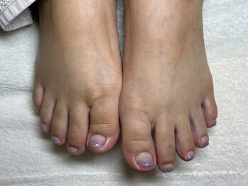 オランダエステティック(Holland Esthetics)/グラデーション