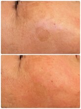 ソリシア(SORISIA)/