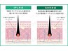 【人気のVIO脱毛】 ★最新クリアスキン美肌脱毛で徹底ケア!