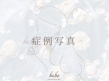 ベベ 表参道(bebe)/症例写真