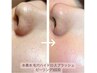 期間限定！！「水素クレンジング」20分 通常価格¥3000→¥2000
