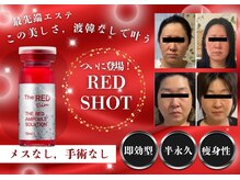 フレアージュ