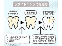 エクシアホワイトニング 日本橋店/ホワイトニングの仕組み