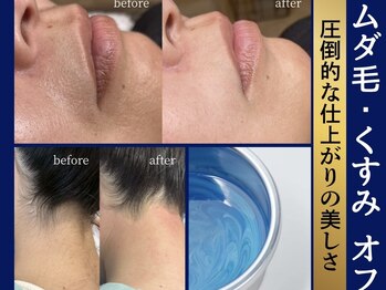 オーガスター(ORGASTAR)の写真/白髪や毛量関係なくしっかり効果が期待できるワックス脱毛！！脱毛が初めての方でも速攻つるつるのお肌へ♪