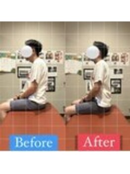 ナオル整体 宮崎院(NAORU整体)/30代男性施術事例【肩こり改善】