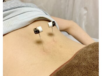 TK鍼灸院/不調の深部に直接アプローチ!