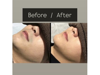 エクラ(eclat)の写真