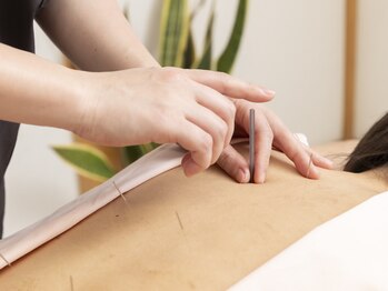 ぽぽらす鍼灸院 接骨院の写真/スマホやPCでの眼精疲労や頭痛、肩こりに！プロによる鍼灸×整体で、目の奥の疲れを解消◎視界もクリアに♪