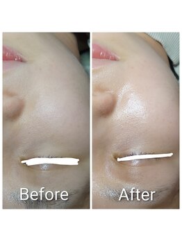 凛美庵/肌のトーンアップ Before→After