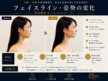 リストアハート(Restore Heart)の雰囲気（フォトギャラリーにもビュフォー&アフターございます♪小顔矯正）