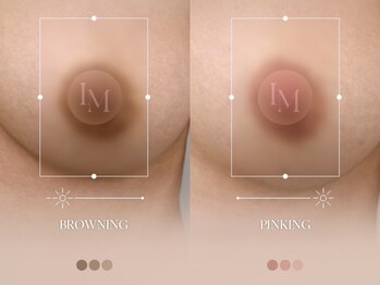 LB BEAUTY SALONの写真/【圧倒的な効果】全国から予約殺到★関西１の症例数を誇る最新ルメラ！クリニック提携だから叶う根本改善