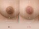 LB BEAUTY SALONの写真/【圧倒的な効果】全国から予約殺到★関西１の症例数を誇る最新ルメラ！クリニック提携だから叶う根本改善