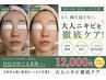 【何年も続く肌荒れ・ニキビ卒業】大人ニキビ徹底ケア