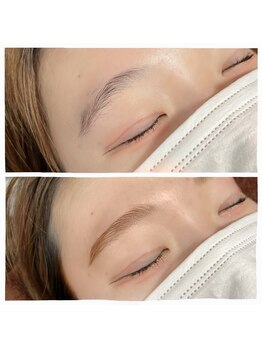 ビーコネクシヨン(美 connection)/HBL ハリウッドブロウリフト