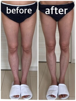 サロンドルフレ(salon de Reflet)/こだわりのオールハンド施術☆