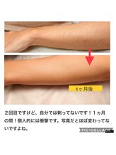 パーソナルエステティックサロン リボーン(ReBorn)/先ずは見えるところ脱毛を♪