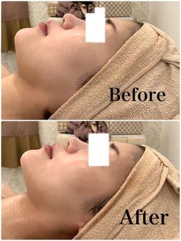 スペチアーレ 夙川/横顔も更に美しく